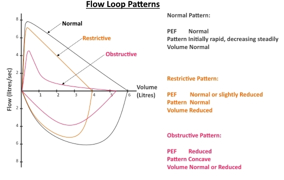 Abnormal Flow Loops