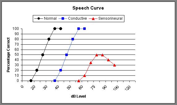 Speech Curve