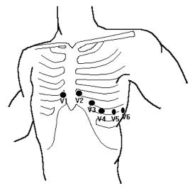 Chest Leads